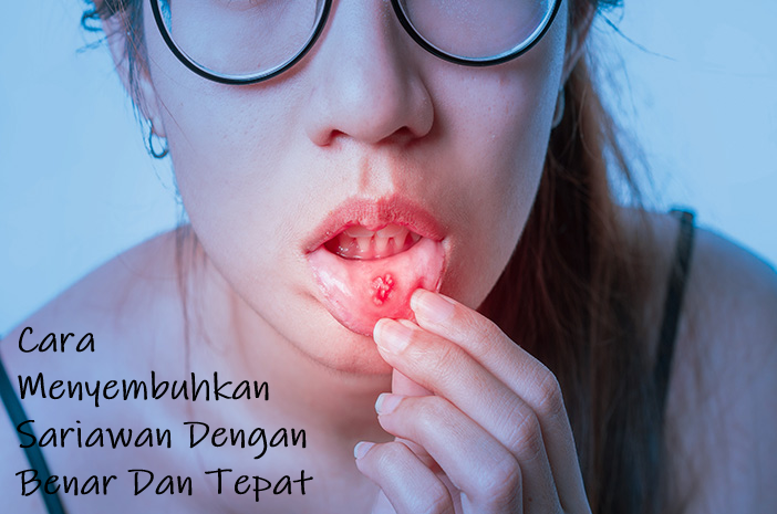cara menyembuhkan sariawan