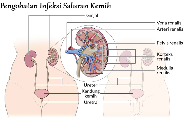 pengobatan infeksi saluran kemih