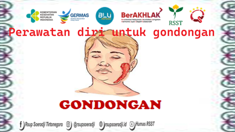 perawatan diri untuk gondongan