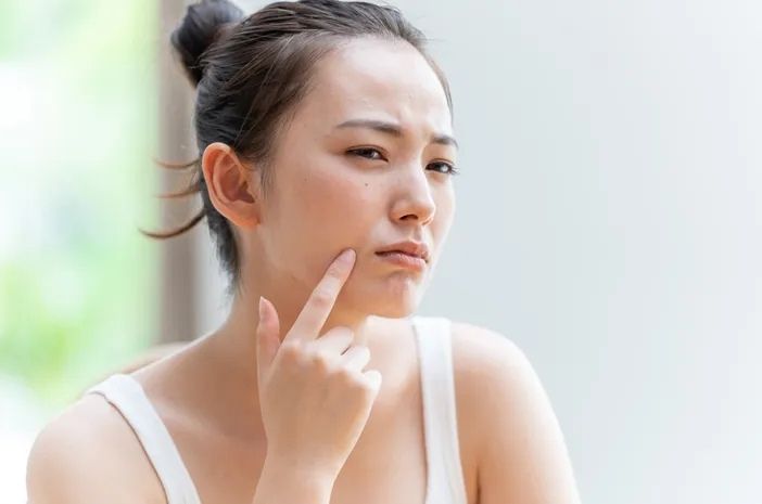 Perawatan Kulit Sensitif agar Tetap Cantik dan Sehat